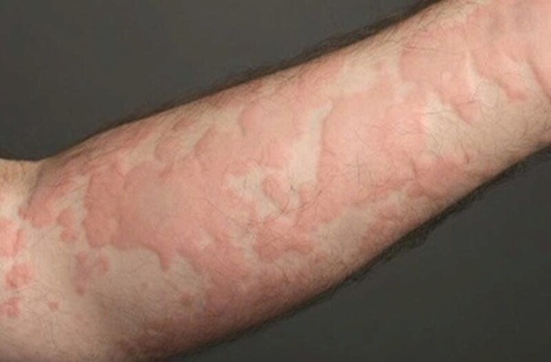 Bệnh viện đa khoa tỉnh Phú Thọ 9 nguoi benh phan ve nguy kich 1