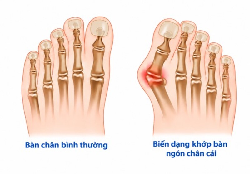 Bệnh viện đa khoa tỉnh Phú Thọ 13 veo ngon chan 1